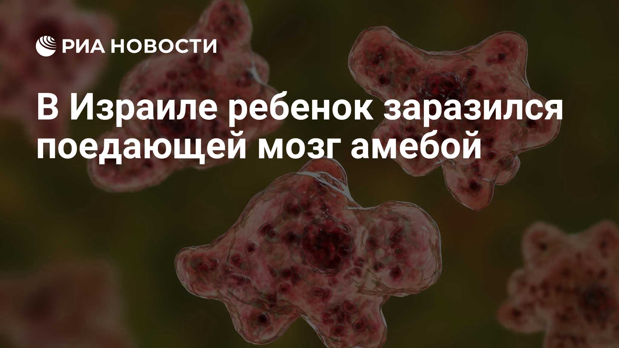 В Израиле ребенок заразился поедающей мозг амебой
